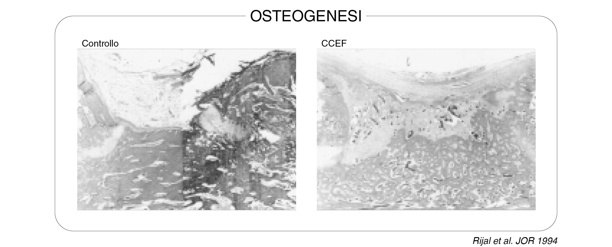 1-Osteogenesi-2