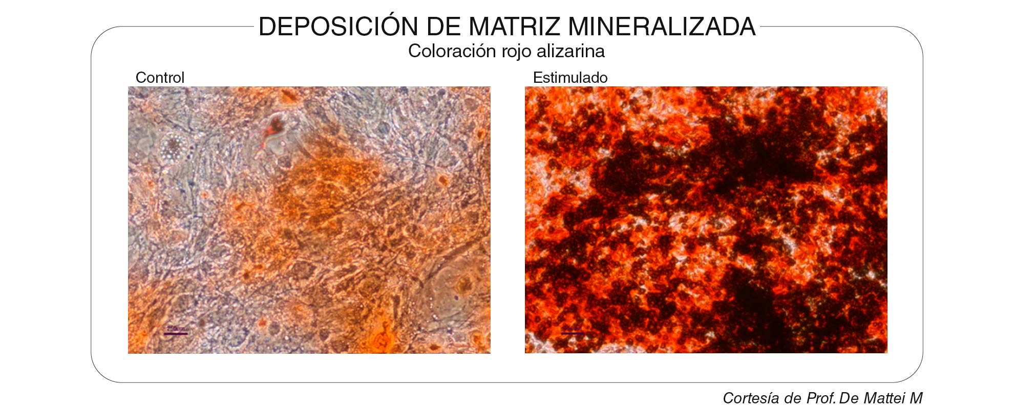 Deposicion_de_matriz-mineralizada