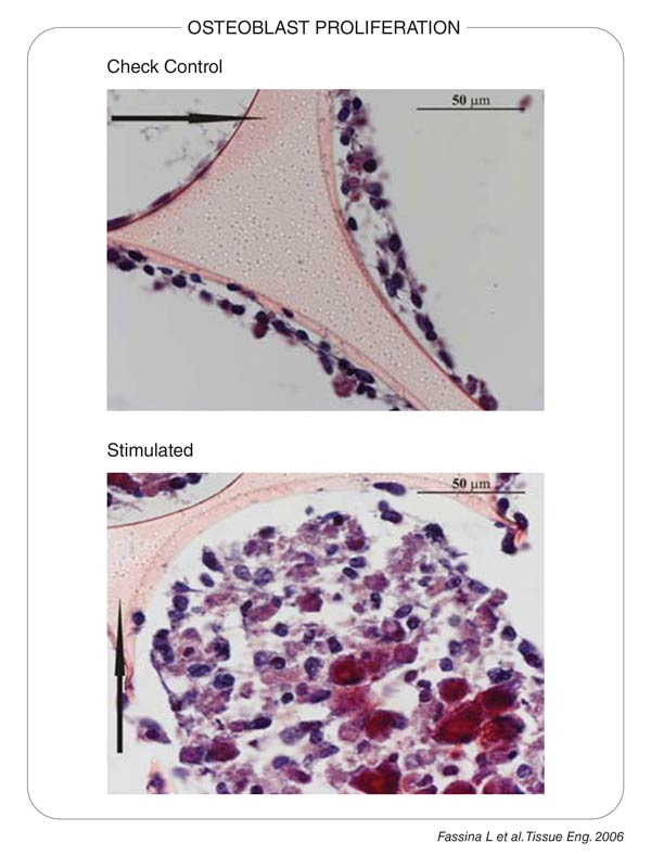 Osteoblast proliferation