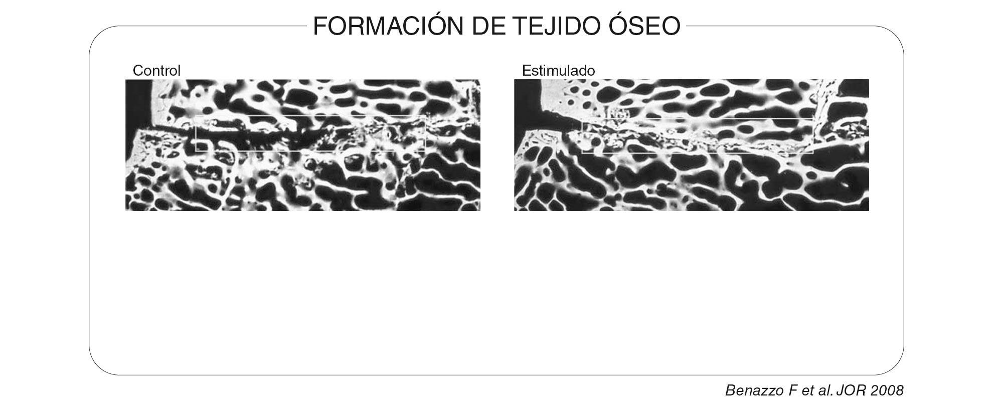 Formacion_de_ejido-oseo_1