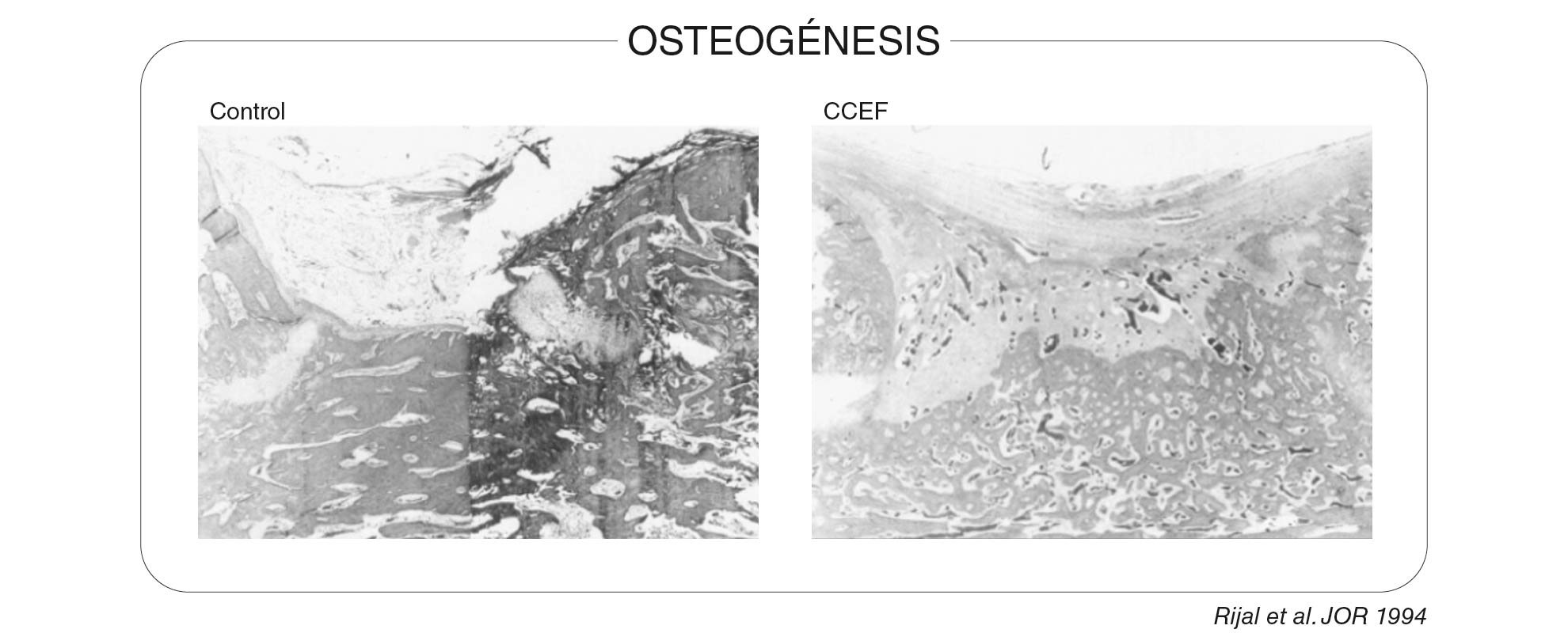 Osteogenesis_2