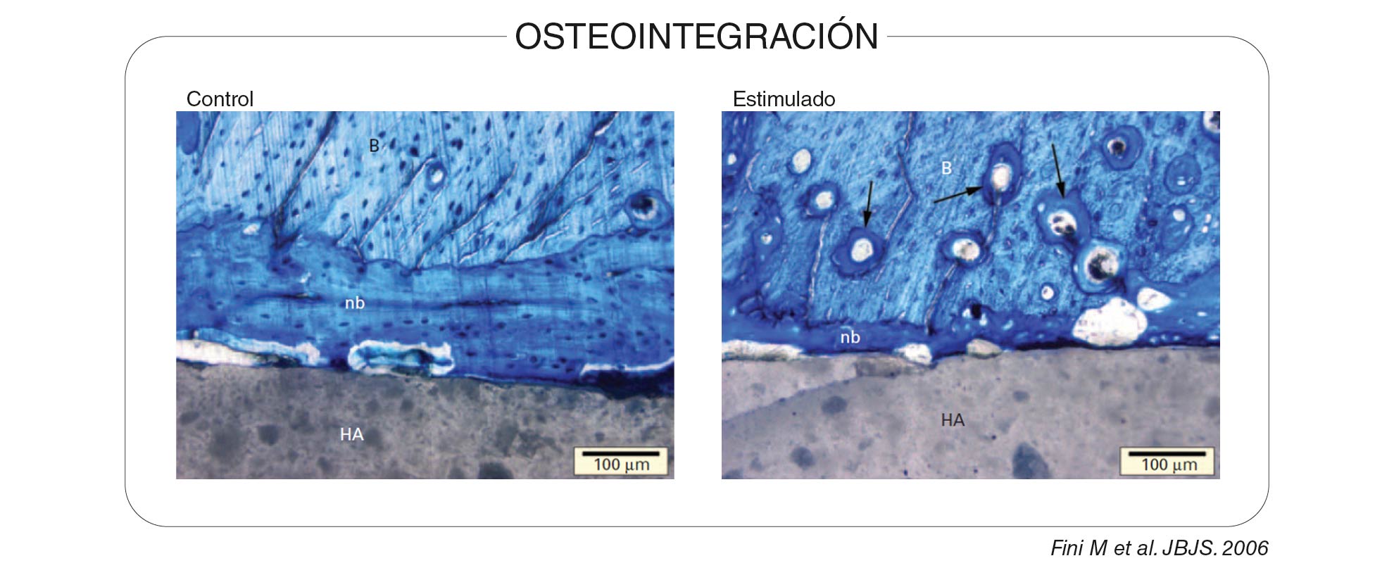 Osteointegracion